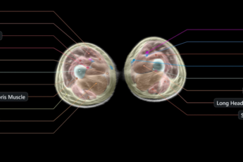Resized Image
